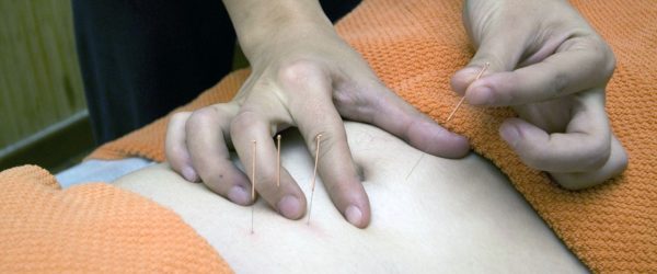 Acupuntura alivia náusea causada por quimioterapia