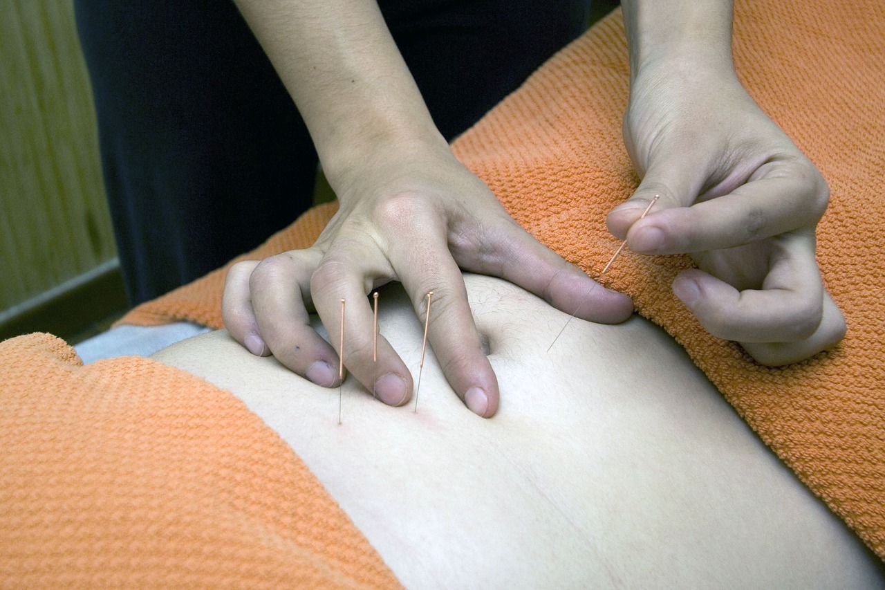 Read more about the article Acupuntura alivia náusea causada por quimioterapia